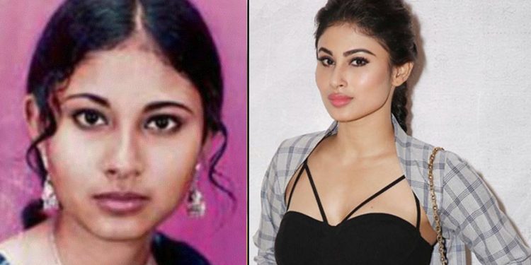 Mouni Roy Before and After Surgery